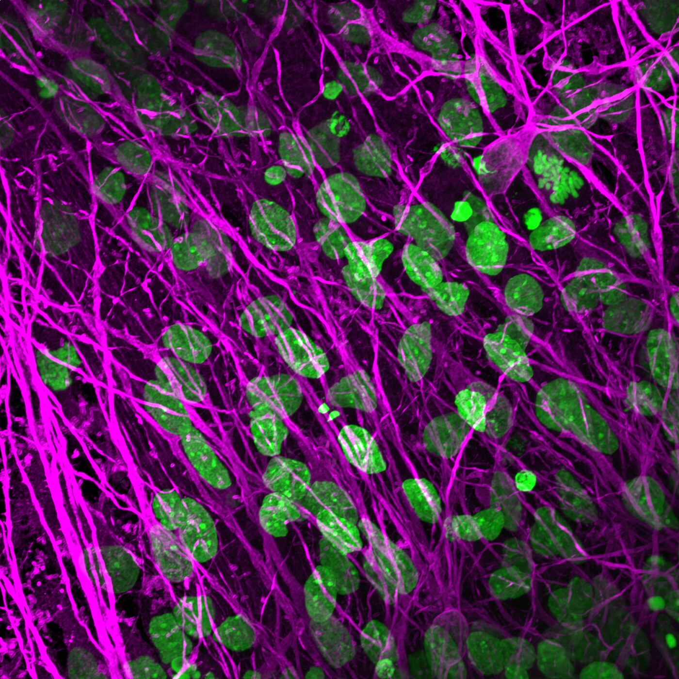 R403C DRP1 mutation, cortical neurons day 60, 100x, series 018