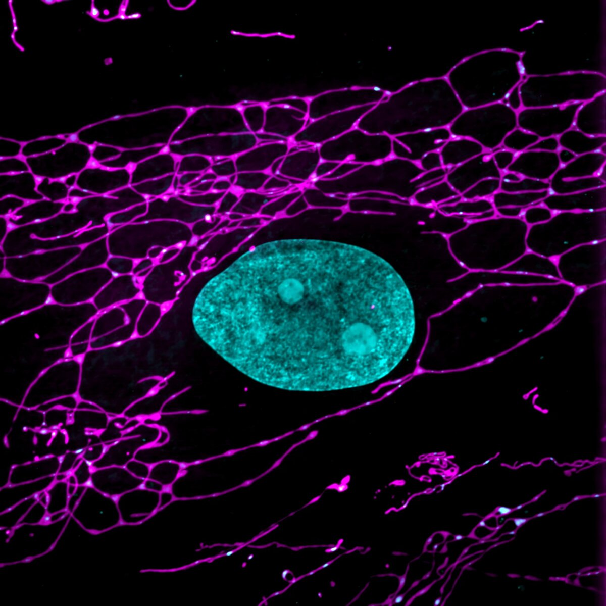 EMPF1 patient fibroblast